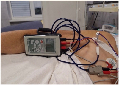 Операцию по установке временного электрокардиостимулятора провели впервые в Республиканской больнице